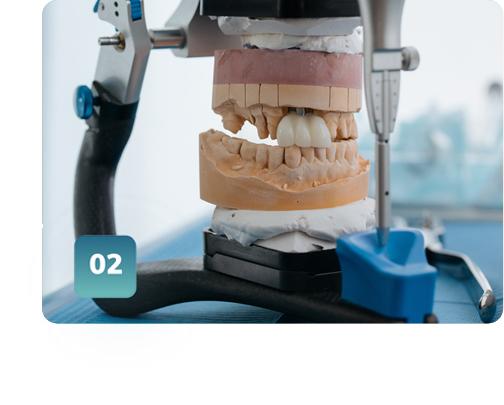 protesi dentale mobile rimpiazzare denti perduti